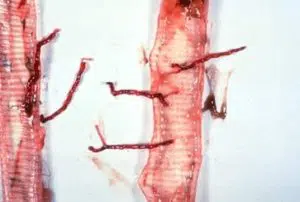 larves de syngamose